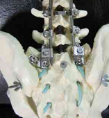 Actualités en orthopédie
